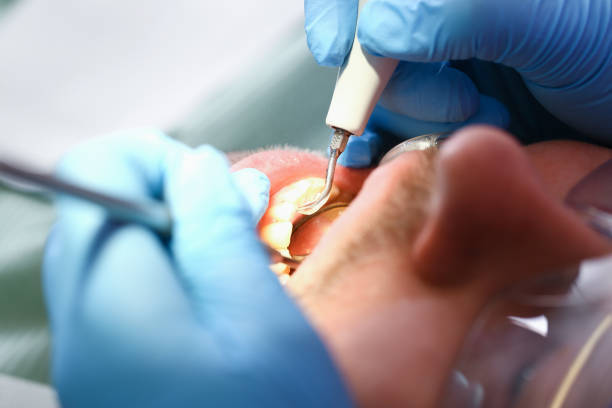 Best Urgent Dental Care for Toothaches in Liberty, KY