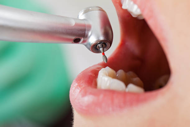 Best Emergency Cosmetic Dentistry (e.g., broken veneers) in Liberty, KY
